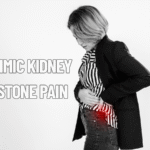 Mimic kidney stone pain
